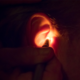 OAM Ohrakupunktmassage nach Luck